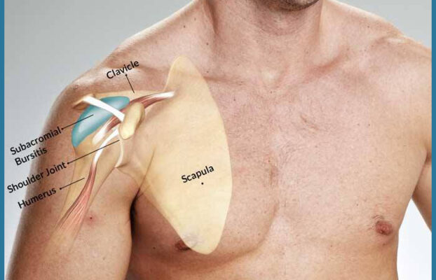 Cos’è la spalla congelata?