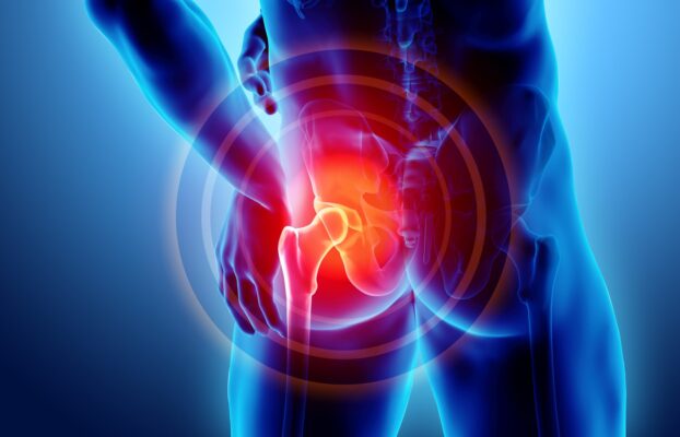 Come recuperare al meglio dopo l’intervento di protesi d’anca